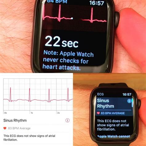 clone apple watch with ekg|apple watch with ekg cost.